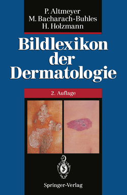 Bildlexikon der Dermatologie von Altmeyer,  Peter, Bacharach-Buhles,  Martina, Buhles,  N., Holzmann,  Hans