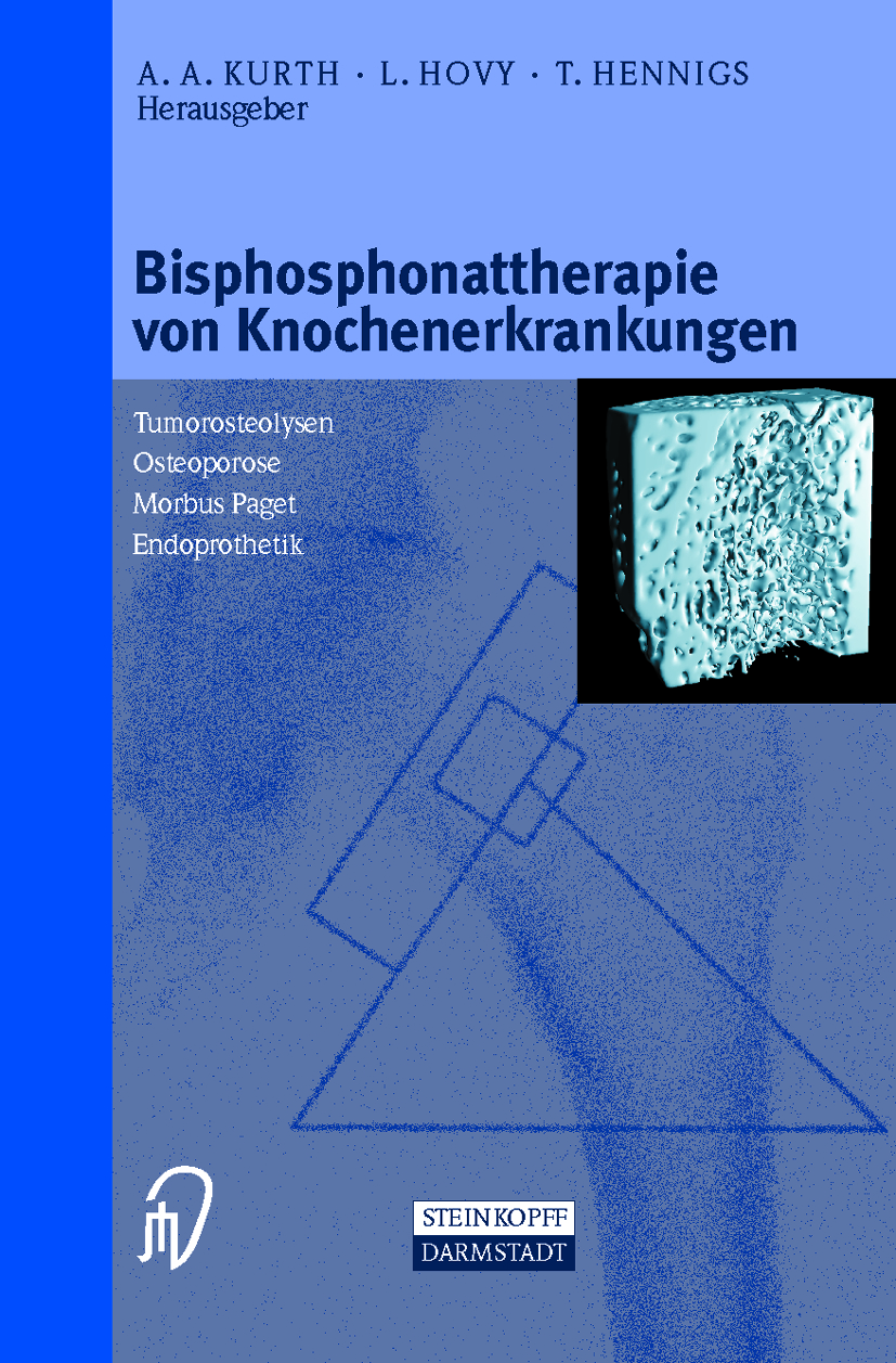 Bisphosphonattherapie Von Knochenerkrankungen Von Hennigs T Hovy L - 