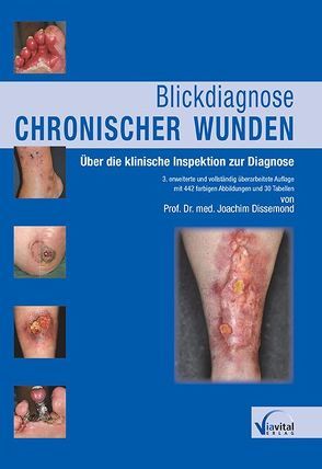 Blickdiagnose chronischer Wunden von Dissemond,  Joachim