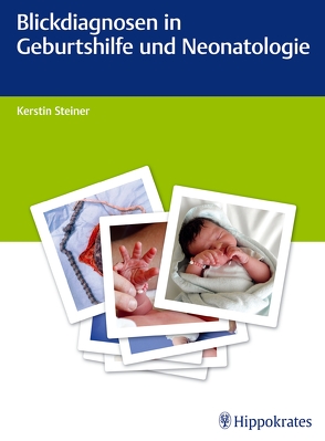 Blickdiagnosen in Geburtshilfe und Neonatologie von Altstaedt,  Julia, Butzheinen,  Ralf, Jäckle,  Karin, Schroth,  Sandra, Steiner,  Kerstin