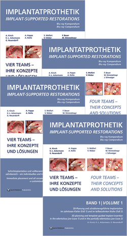 Blu Ray-Kompendium Implantatprothetik Band 1-4 von Ackermann,  Karl-Ludwig, Beuer,  Florian, Happe,  Arndt, Kirsch,  Axel, Neuendorff,  Gerhard, Nolte,  Andreas, Schweiger,  Josef, Stimmelmayr,  Michael, Weber,  Volker