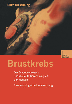 Brustkrebs von Kirschning,  Silke