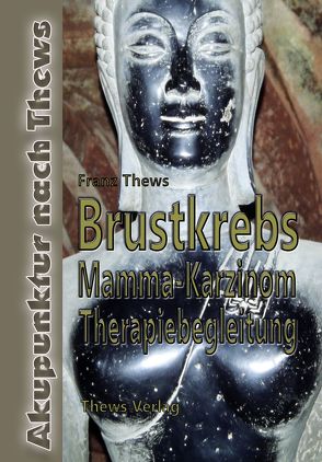 Brustkrebs – Mamma-Karzinom von Thews,  Franz