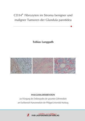 CD34+ Fibrozyten im Stroma benigner und maligner Tumoren der Glandula parotidea von Langguth,  Tobias