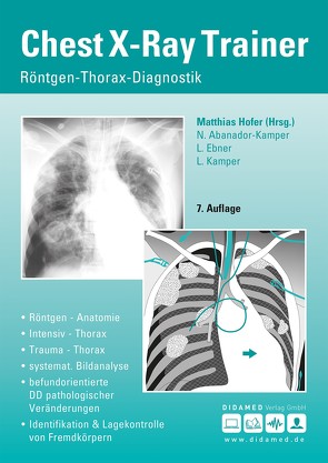 Chest-X-Ray Trainer von Abanador-Kamper,  Nadine, Ebner,  Lukas, Hofer,  Matthias, Kamper,  Lars