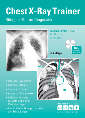 Chest-X-Ray Trainer von Abanador,  Nadine, Antoch,  Gerald, Hofer,  Matthias, Kamper,  Lars