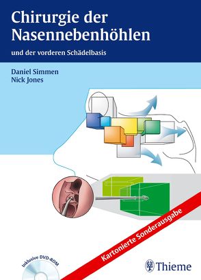 Chirurgie der Nasennebenhöhlen von Jones,  Nicholas S., ORL-Zentrum Klinik Hirslanden