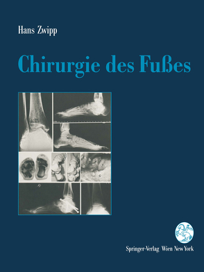 Chirurgie des Fußes von Zwipp,  Hans