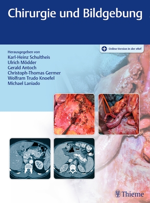 Chirurgie und Bildgebung von Antoch,  Gerald, Germer,  Christoph-Thomas, Knoefel,  Wolfram Trudo, Laniado,  Michael, Mödder,  Ulrich, Schultheis,  Karl-Heinz