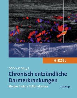 Chronisch entzündliche Darmerkrankungen von Andus,  T., Bischoff,  Stephan C., Buhr,  H. J., Caspary,  W. F., Deutsche Morbus Crohn/Colitis ulcerosa Vereinigung - DCCV e.V., Dietrich,  C. F., Dignass,  A., Eceterski,  A., Engelmann,  N., Fleig,  W. E., Geissler,  A., Herrlinger,  K., Keim,  V., Keller,  K.-M., Kießlich,  R., Kroesen,  A.-J., Krummenerl,  A., Lembcke,  B., Lümmen,  D., Malchow,  H., Mattes,  H., Möller,  G., Moser,  G., Müller-Nothmann,  S.-D., Raedler,  A., Raedsch,  R., Schölmerich,  J., Schürmann,  K., Stallmach,  A., Stange,  E. F., Vestweber,  K.-H., Zillessen,  Eberhard