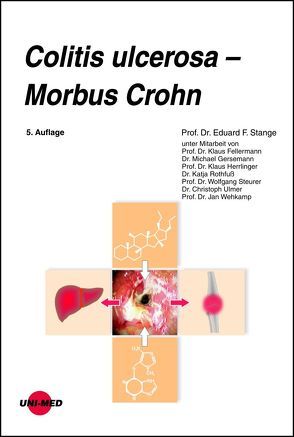 Colitis ulcerosa – Morbus Crohn von Stange,  Eduard F.