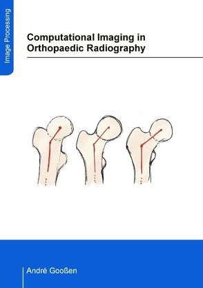 Computational Imaging in Orthopaedic Radiography von Gooßen,  André