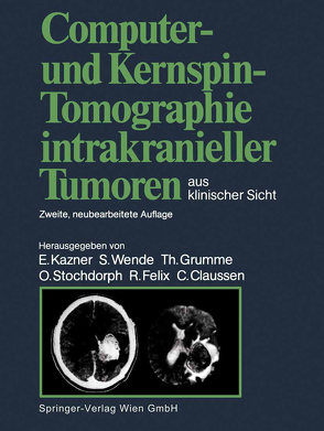 Computer- und Kernspin-Tomographie intrakranieller Tumoren aus klinischer Sicht von Claussen,  C., Claussen,  Claus, Fahlbusch,  R., Felix,  R., Felix,  Roland, Grumme,  T., Grumme,  Thomas, Heinzerling,  J., Iglesias-Rozas,  J.R., Kazner,  E., Kazner,  Ekkehard, Kretzschmar,  K., Laniado,  M., Lanksch,  W., Müller-Forell,  W., Newton,  T.H., Schörner,  W., Schroth,  G., Schulz,  B., Stochdorph,  O., Stochdorph,  Otto, Sze,  G., Wende,  S., Wende,  Sigurd