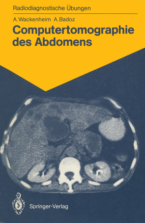 Computertomographie des Abdomens von Badoz,  Armelle, Hauenstein,  Elisabeth, Wackenheim,  Auguste