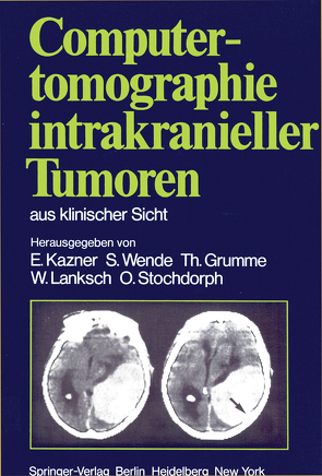 Computertomographie intrakranieller Tumoren aus klinischer Sicht von Bradac,  G.B., Büll,  U., Fahlbusch,  R., Grumme,  R., Grumme,  T., Kazner,  E., Kretzschmar,  K., Lanksch,  W., Meese,  W., Schramm,  J., Steinhoff,  H., Stochdorph,  O., Wende,  S.