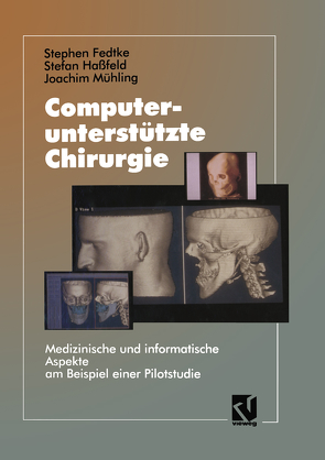 Computerunterstützte Chirurgie von Fedtke,  Stephen