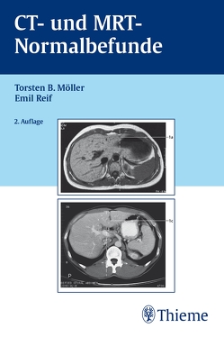 CT und MRT Normalbefunde von Möller,  Torsten Bert, Reif,  Emil