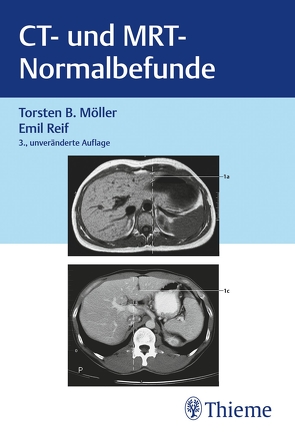 CT und MRT Normalbefunde von Möller,  Torsten Bert, Reif,  Emil