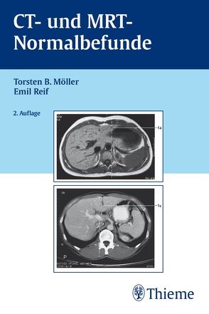 CT und MRT Normalbefunde von Möller,  Torsten Bert, Reif,  Emil