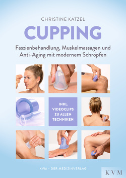 Cupping von Kätzel,  Christine