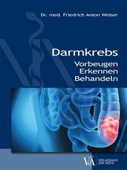 Darmkrebs von Ferlitsch,  Monika, Hahsler,  Lisa, Schaub,  Hagen, Slavka,  Georg, Weiser,  MCs,  Friedrich Anton