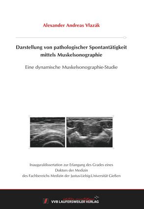 Darstellung von pathologischer Spontantätigkeit mittels Muskelsonographie von Vlazák,  Alexander