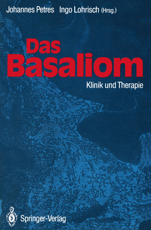 Das Basaliom von Lohrisch,  Ingo, Petres,  Johannes