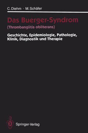 Das Buerger-Syndrom (Thrombangiitis obliterans) von Diehm,  Curt, Schaefer,  Michael