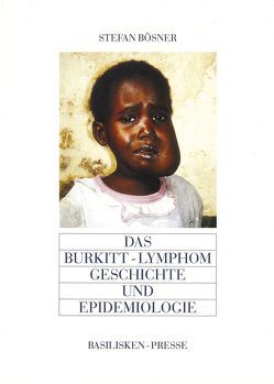 Das Burkitt-Lymphom von Bösner,  Stefan