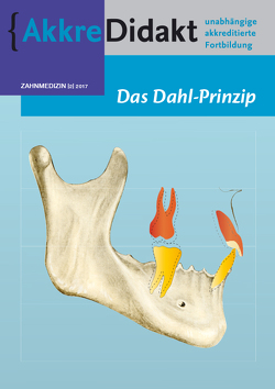 Das Dahl-Prinzip von Wabeke,  Kya