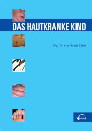 Das hautkranke Kind von Zabel,  Maria