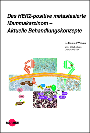 Das HER2-positive metastasierte Mammakarzinom – Aktuelle Behandlungskonzepte von Welslau,  Manfred