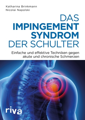 Das Impingement-Syndrom der Schulter von Brinkmann,  Katharina, Napolski,  Nicolai