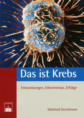 Das ist Krebs von Grundmann,  Ekkehard