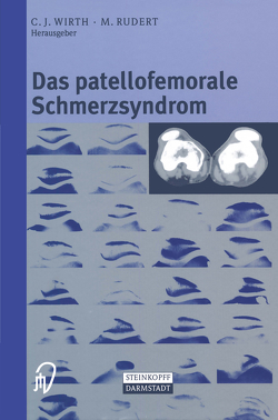 Das patellofemorale Schmerzsyndrom von Rudert,  M., Wirth,  C.J.