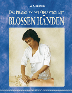 Das Phänomen der Operation mit blossen Händen von Goldner,  Jay