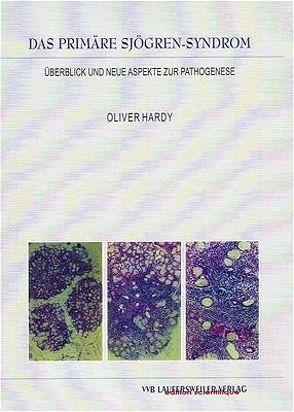 Das primäre Sjögren-Syndrom: Überblick und neue Aspekte zur Pathogenese von Hardy,  Oliver