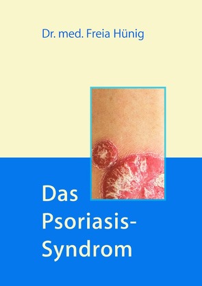 Das Psoriasis-Syndrom von Hünig,  Dr. Freia