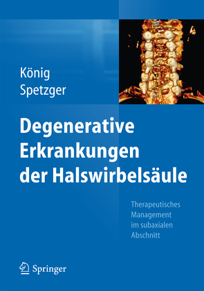 Degenerative Erkrankungen der Halswirbelsäule von König,  Stefan Alexander, Spetzger,  Uwe