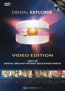 Dental Explorer Video Edition von Bengel,  Wolfgang, Prüfert,  Michael-Kurt