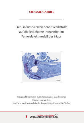 Der Einfluss verschiedener Werkstoffeauf die knöcherne Integration imFemurdefektmodell der Maus von Gabriel,  Stefanie