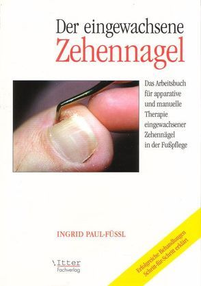 Der eingewachsene Zehennagel von Itter,  Alexander, Krause,  Ingrid, Paul-Füssl,  Ingrid