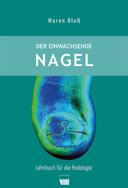 Der einwachsende Nagel von Bloss,  Maren