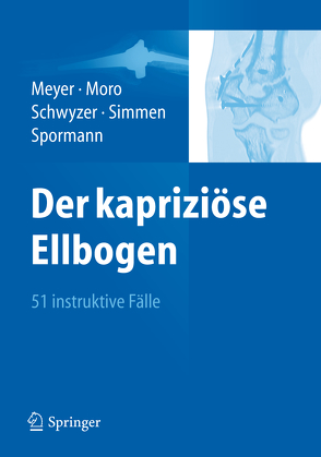 Der kapriziöse Ellbogen von Meyer,  Rainer-Peter, Moro,  Fabrizio, Schwyzer,  Hans-Kaspar, Simmen,  Beat René, Spormann,  Christoph