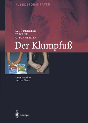 Der Klumpfuss von Döderlein,  Leonhard, Fixsen,  J.A., Schneider,  Urs, Wenz,  Wolfram