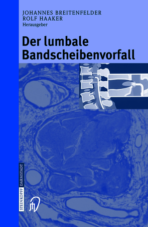 Der lumbale Bandscheibenvorfall von Breitenfelder,  J., Breitenfelder,  M., Haaker,  R.