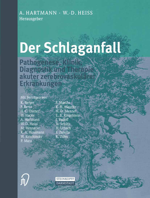 Der Schlaganfall von Hartmann,  A., Heiss,  W.-D.