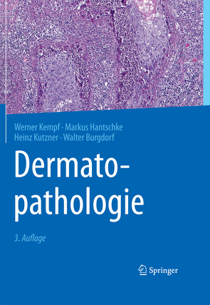 Dermatopathologie von Burgdorf,  Walter, Hantschke,  Markus, Kempf,  Werner, Kutzner,  Heinz