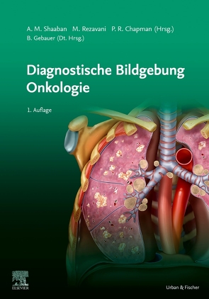 Diagnostische Bildgebung Onkologie von Akram M.,  Shaaban