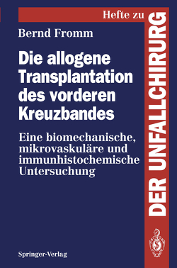 Die allogene Transplantation des vorderen Kreuzbandes von Fromm,  Bernd